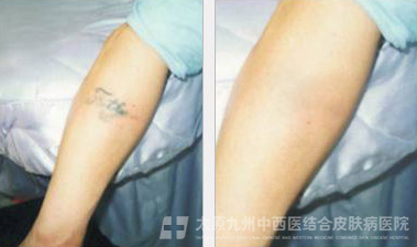 运城皮肤病医院