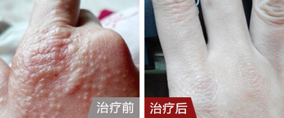 运城皮肤病医院