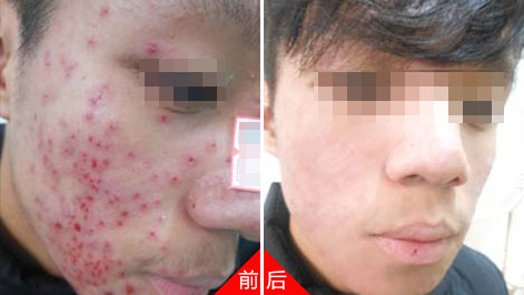运城皮肤病医院