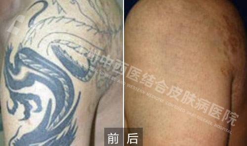 长治皮肤病医院
