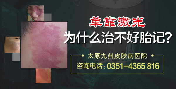 忻州皮肤病医院