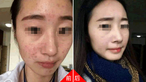 忻州皮肤病医院