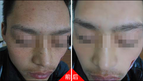  阳泉皮肤病医院