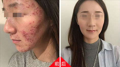  阳泉皮肤病医院