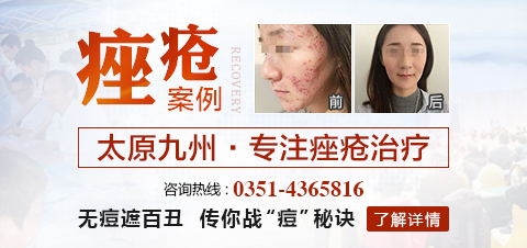 阳泉皮肤病医院